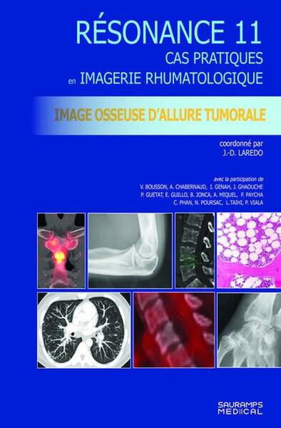 Resonance Diagnostic en Imagerie Rhumatologique Tome 11; Imagerie