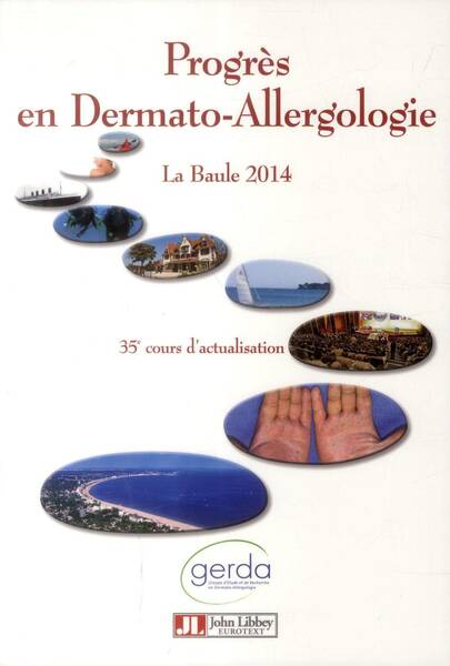 Progres en Dermato Allergologie; la Baule 2014: 35e Cours D