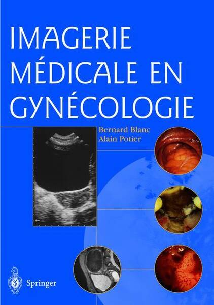 Imagerie Medicale en Gynecologie