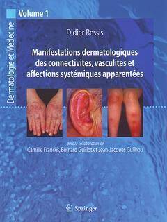 Manifestations dermatologiques des connectivites, vasculites et affect