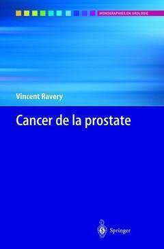 Cancer de la prostate