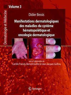 Manifestations dermatologiques des maladies du système hématopoïtiques