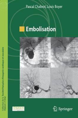 Embolisation (Coll de la Société française d'imagerie cardiaque et vas